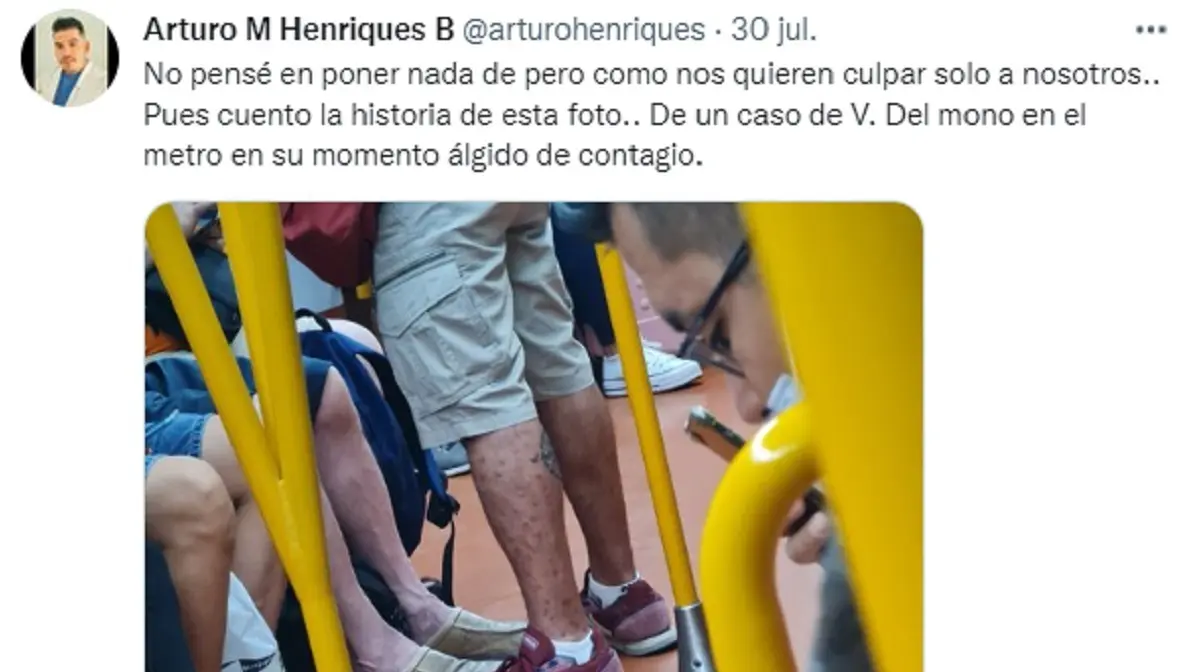 Un contagiado de viruela del mono viaja en el Metro de Madrid
